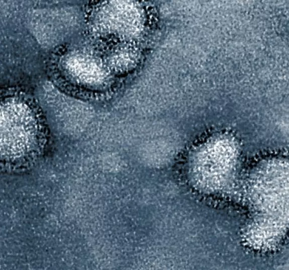 virus influenza virus influenza